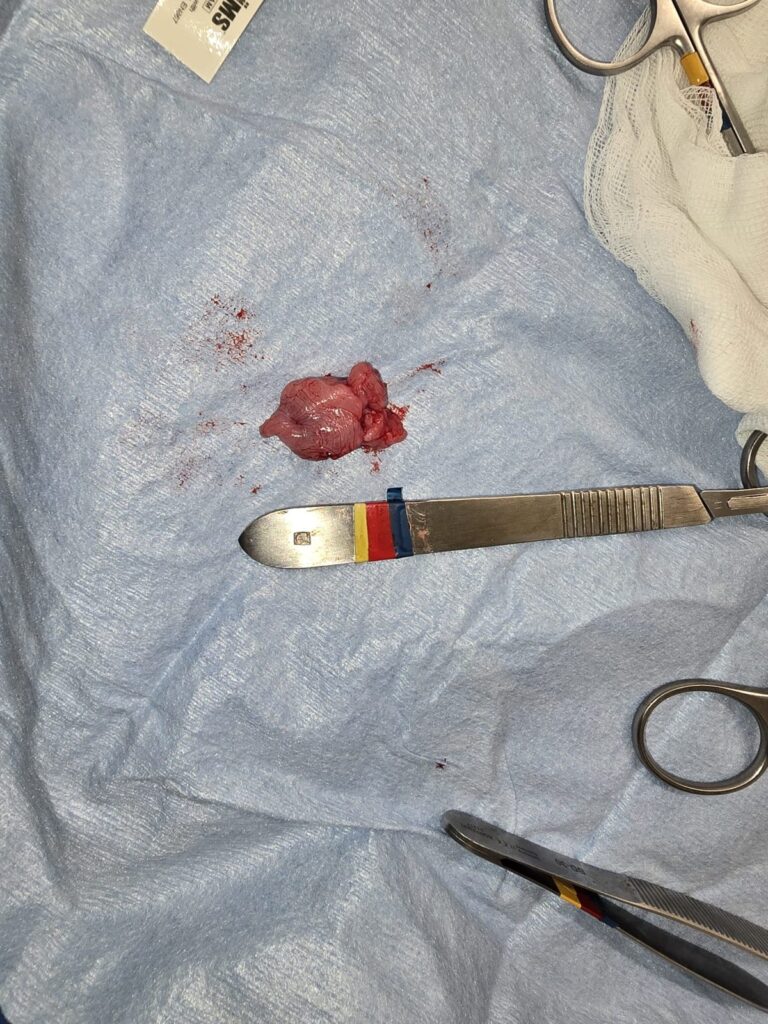 Excess soft palate tissue removed during BOAS surgery